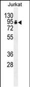 Poly(A) Polymerase Alpha antibody, PA5-48259, Invitrogen Antibodies, Western Blot image 