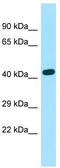 Exocyst complex component 3-like protein 2 antibody, TA331251, Origene, Western Blot image 