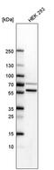 SET Domain Containing 6, Protein Lysine Methyltransferase antibody, PA5-59588, Invitrogen Antibodies, Western Blot image 