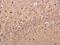 Beta-Secretase 2 antibody, GTX113951, GeneTex, Immunohistochemistry paraffin image 