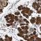 TPD52 Like 1 antibody, NBP1-84313, Novus Biologicals, Immunohistochemistry frozen image 