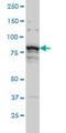 Threonine Synthase Like 1 antibody, H00079896-M08, Novus Biologicals, Western Blot image 