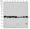 Cyclin Dependent Kinase 1 antibody, NBP2-37626, Novus Biologicals, Western Blot image 