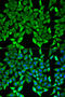 Myelin-oligodendrocyte glycoprotein antibody, STJ27306, St John