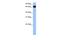 Heat Shock Protein Family A (Hsp70) Member 1 Like antibody, NBP1-56938, Novus Biologicals, Western Blot image 