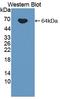 Interleukin 12B antibody, LS-C372429, Lifespan Biosciences, Western Blot image 