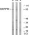 R3H Domain And Coiled-Coil Containing 1 Like antibody, TA315380, Origene, Western Blot image 