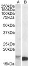 Translocator protein antibody, STJ71851, St John