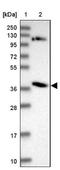 SH2 Domain Containing 4B antibody, NBP1-90896, Novus Biologicals, Immunohistochemistry frozen image 