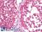 Vinculin antibody, LS-B10133, Lifespan Biosciences, Immunohistochemistry paraffin image 