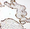 Matrix Metallopeptidase 14 antibody, LS-C313258, Lifespan Biosciences, Immunohistochemistry paraffin image 