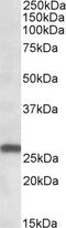 MOB Family Member 4, Phocein antibody, TA311438, Origene, Western Blot image 