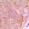 Nuclear Transport Factor 2 antibody, LS-C368705, Lifespan Biosciences, Immunohistochemistry paraffin image 