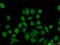 GTF2I Repeat Domain Containing 1 antibody, 17052-1-AP, Proteintech Group, Immunofluorescence image 