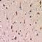 Activin A Receptor Type 1C antibody, LS-C668898, Lifespan Biosciences, Immunohistochemistry paraffin image 