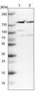 Protein Phosphatase 1 Regulatory Subunit 13B antibody, NBP1-90078, Novus Biologicals, Western Blot image 