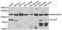 Chloride Voltage-Gated Channel 7 antibody, A6886, ABclonal Technology, Western Blot image 