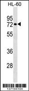 Ras Homolog Family Member T2 antibody, 59-120, ProSci, Western Blot image 