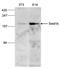 SET Domain Containing 1B, Histone Lysine Methyltransferase antibody, PA5-40072, Invitrogen Antibodies, Western Blot image 