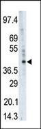 Phosphorylase Kinase Catalytic Subunit Gamma 1 antibody, 62-744, ProSci, Western Blot image 