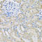 Decapping MRNA 2 antibody, A02293-1, Boster Biological Technology, Immunohistochemistry paraffin image 