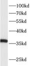 Acid Phosphatase 4 antibody, FNab00103, FineTest, Western Blot image 