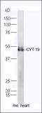 Cartilage Oligomeric Matrix Protein antibody, orb182890, Biorbyt, Western Blot image 