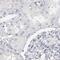 Lymphocyte Antigen 6 Family Member D antibody, PA5-55171, Invitrogen Antibodies, Immunohistochemistry frozen image 