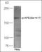 Interleukin 1 Receptor Associated Kinase 1 antibody, orb1678, Biorbyt, Western Blot image 