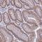 Mitochondrial Calcium Uptake 2 antibody, NBP1-91864, Novus Biologicals, Immunohistochemistry frozen image 