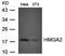 Fibroblast Growth Factor Receptor 4 antibody, orb69581, Biorbyt, Western Blot image 