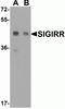 Single Ig And TIR Domain Containing antibody, NBP1-76599, Novus Biologicals, Western Blot image 
