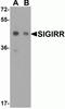 Single Ig IL-1-related receptor antibody, NBP1-76599, Novus Biologicals, Western Blot image 