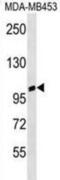 Ankyrin Repeat Domain 20 Family Member A3 antibody, abx030656, Abbexa, Western Blot image 