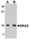 Spindle And Kinetochore Associated Complex Subunit 2 antibody, A06326-1, Boster Biological Technology, Western Blot image 