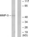Matrix Metallopeptidase 3 antibody, LS-C118527, Lifespan Biosciences, Western Blot image 