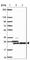 Ribosomal Protein S5 antibody, HPA055878, Atlas Antibodies, Western Blot image 