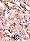 Branched Chain Keto Acid Dehydrogenase Kinase antibody, abx033187, Abbexa, Immunohistochemistry paraffin image 