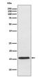 Vesicle Associated Membrane Protein 2 antibody, M02331-1, Boster Biological Technology, Western Blot image 