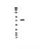 Interleukin 1 Receptor Associated Kinase 1 antibody, A01021, Boster Biological Technology, Western Blot image 