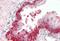 BH3 Interacting Domain Death Agonist antibody, MBS248705, MyBioSource, Immunohistochemistry paraffin image 