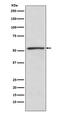 Transducin Beta Like 1 X-Linked Receptor 1 antibody, M04524, Boster Biological Technology, Western Blot image 