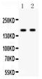 Glutamate Ionotropic Receptor NMDA Type Subunit 2A antibody, PB9335, Boster Biological Technology, Western Blot image 