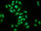 Trinucleotide repeat-containing gene 6B protein antibody, LS-C672559, Lifespan Biosciences, Immunofluorescence image 