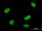 SWI/SNF Related, Matrix Associated, Actin Dependent Regulator Of Chromatin, Subfamily A Like 1 antibody, H00050485-B01P, Novus Biologicals, Immunocytochemistry image 