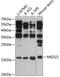 Mediator Complex Subunit 22 antibody, 15-221, ProSci, Western Blot image 