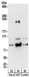 Holocarboxylase Synthetase antibody, NBP2-32174, Novus Biologicals, Western Blot image 