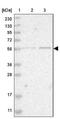 Zinc Finger Protein 695 antibody, NBP1-80783, Novus Biologicals, Western Blot image 