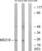 Mediator Complex Subunit 18 antibody, LS-C120076, Lifespan Biosciences, Western Blot image 