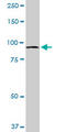 MTSS I-BAR Domain Containing 1 antibody, LS-C105089, Lifespan Biosciences, Western Blot image 